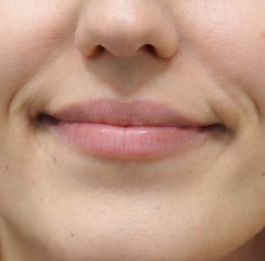 Before/After Image